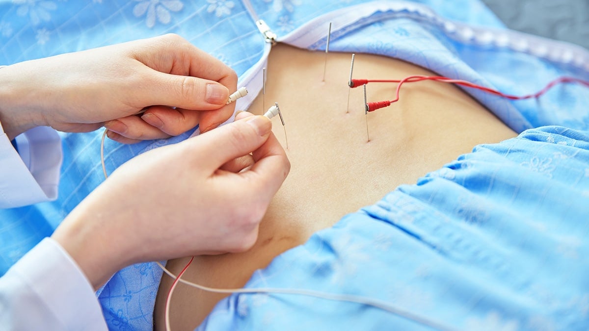 한의원 한방치료